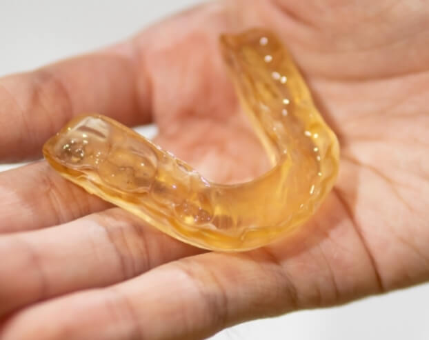 Hand holding a nightguard for bruxism